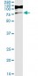 RIOK3 Antibody (monoclonal) (M01)