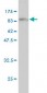 RIOK3 Antibody (monoclonal) (M01)