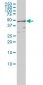 RIOK3 Antibody (monoclonal) (M01)