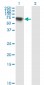 RIOK3 Antibody (monoclonal) (M01)