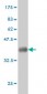 RIOK3 Antibody (monoclonal) (M02)