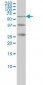 RIOK3 Antibody (monoclonal) (M02)