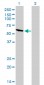 RIOK3 Antibody (monoclonal) (M02)