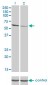 RIOK3 Antibody (monoclonal) (M02)