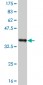RIPK2 Antibody (monoclonal) (M02)