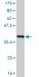 RIPK2 Antibody (monoclonal) (M02)