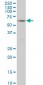 RIPK2 Antibody (monoclonal) (M02)