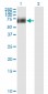 RIPK2 Antibody (monoclonal) (M02)