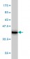 RIPK2 Antibody (monoclonal) (M05)
