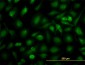 RLBP1 Antibody (monoclonal) (M02)