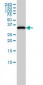 RLBP1 Antibody (monoclonal) (M02)