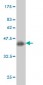 RNF139 Antibody (monoclonal) (M01)