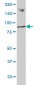 RNF139 Antibody (monoclonal) (M01)