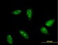 RNF6 Antibody (monoclonal) (M01)