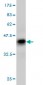 RNF6 Antibody (monoclonal) (M01)