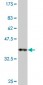 ROBO2 Antibody (monoclonal) (M01)