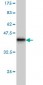 ROCK1 Antibody (monoclonal) (M01)