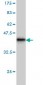 ROCK1 Antibody (monoclonal) (M01)