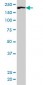 ROCK1 Antibody (monoclonal) (M01)