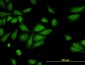 ROCK2 Antibody (monoclonal) (M01)