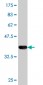 ROCK2 Antibody (monoclonal) (M01)