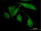 ROCK2 Antibody (monoclonal) (M02)