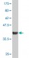 ROCK2 Antibody (monoclonal) (M02)