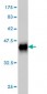 ROD1 Antibody (monoclonal) (M01)