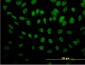 ROD1 Antibody (monoclonal) (M01)