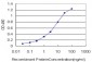 RORB Antibody (monoclonal) (M06)