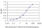 RORB Antibody (monoclonal) (M08)