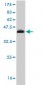 RORB Antibody (monoclonal) (M08)