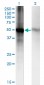 RORB Antibody (monoclonal) (M08)