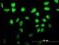 RP13-297E16.1 Antibody (monoclonal) (M02)