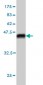 RP6-213H19.1 Antibody (monoclonal) (M01)