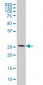 RPL13 Antibody (monoclonal) (M01)