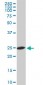 RPL19 Antibody (monoclonal) (M01)