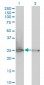RPL19 Antibody (monoclonal) (M01)