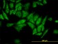 RPL4 Antibody (monoclonal) (M01)