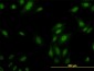 RPL9 Antibody (monoclonal) (M01)