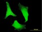 RPS2 Antibody (monoclonal) (M01)