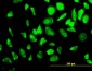RPS23 Antibody (monoclonal) (M02)