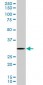 RPS3 Antibody (monoclonal) (M03)