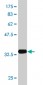 RPS5 Antibody (monoclonal) (M01)