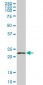 RPS5 Antibody (monoclonal) (M01)