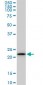 RPS5 Antibody (monoclonal) (M01)