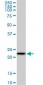 RPS5 Antibody (monoclonal) (M01)