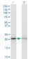 RPS5 Antibody (monoclonal) (M01)