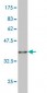 RPS5 Antibody (monoclonal) (M02)