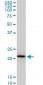 RPS5 Antibody (monoclonal) (M02)